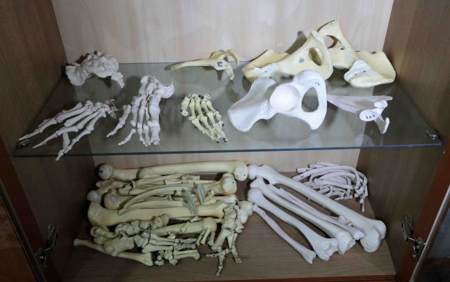 استخوان های دست و پا