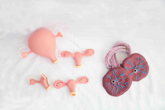 مولاژهای معاینه رحم همراه با جفت