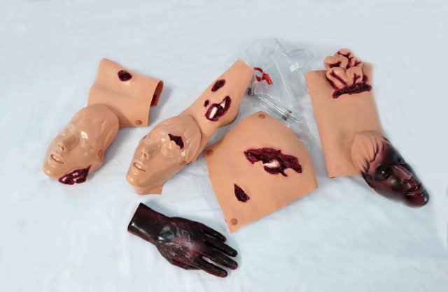 انواع مدل زخم و سوختگی